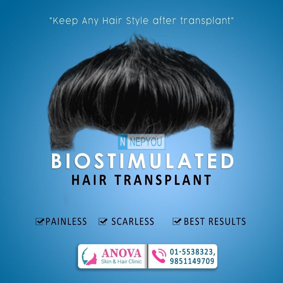 BIOSTIMULATED HAIR TRANSPLANT | Free Ads Nepal | NepYou